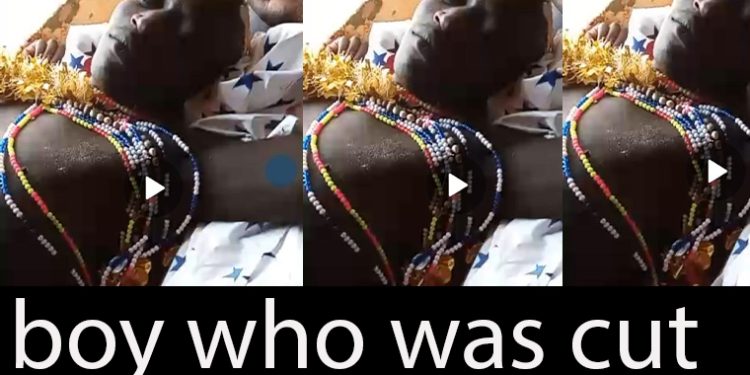 Another Traditional Surgeon Survives Lynching After Circumcision Mishap