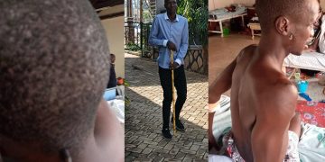 I Feel Like My Body is Breaking Apart-Herdsman Recounts Brutal Torture Ordeal