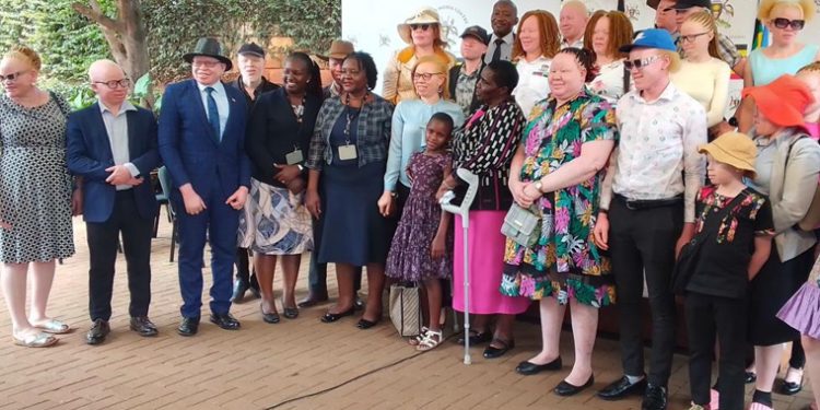 Persons with Albinism in Uganda Decry Stigma, Discrimination