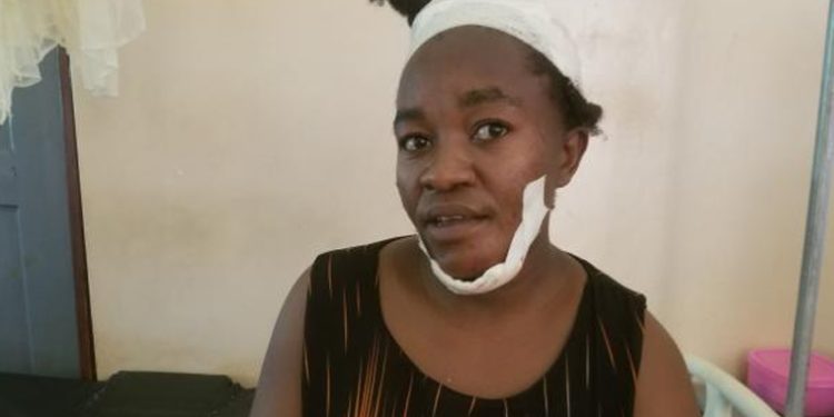 Survivors of Mukono-Katosi Bus Accident Share Stories of Survival