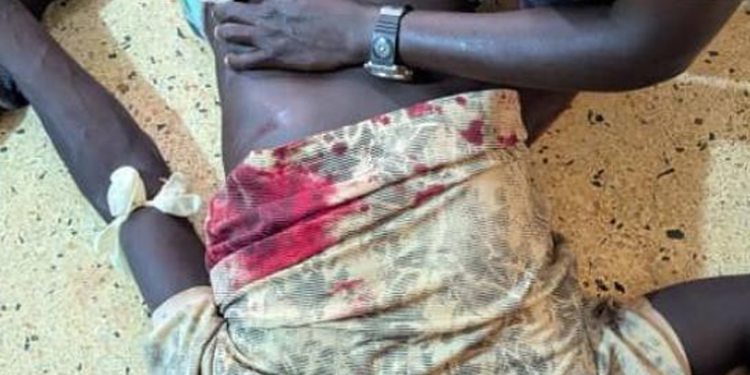 Running Battles Erupt in Yumbe Over Pork Joint Protest