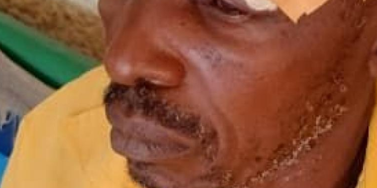 Police Denies Hand in Electoral Violence in Bulambuli District