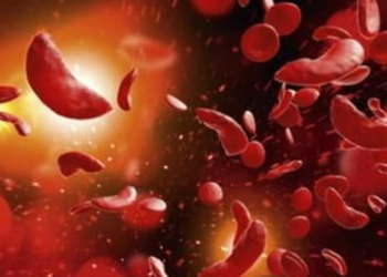 Nalufenya Hospital Registers 800 Cases of Sickle Cell Disease per Monthly