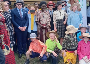 Kadaga Demands Accountability For funds Raised to Support Persons Living With Albinism