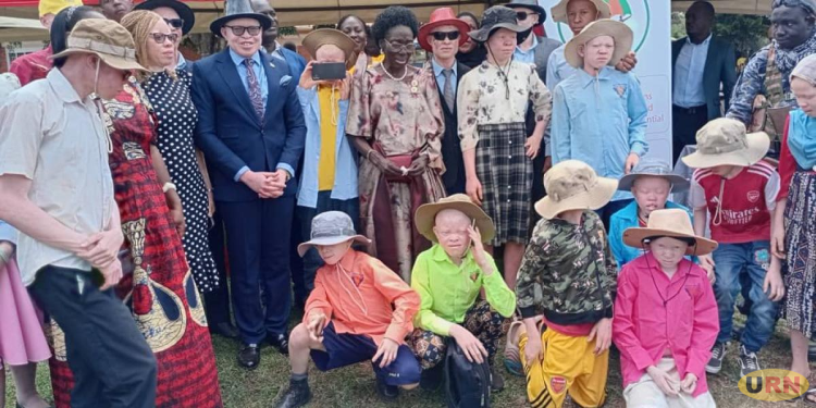 Kadaga Demands Accountability For funds Raised to Support Persons Living With Albinism