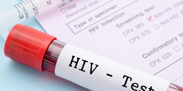 Local Gov’ts Asked to Boost School HIV Response Through Budget Allocation